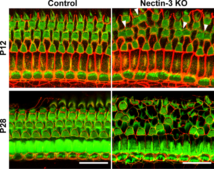 Figure. Nectin KO mice went deaf due to the loss of hair cells.