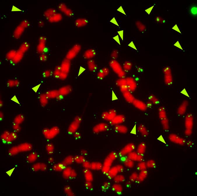 Human Chromosomes