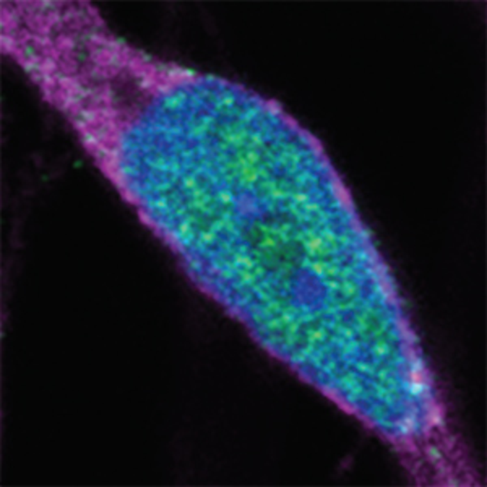 Nuclear accumulation of CHMP7 in ALS