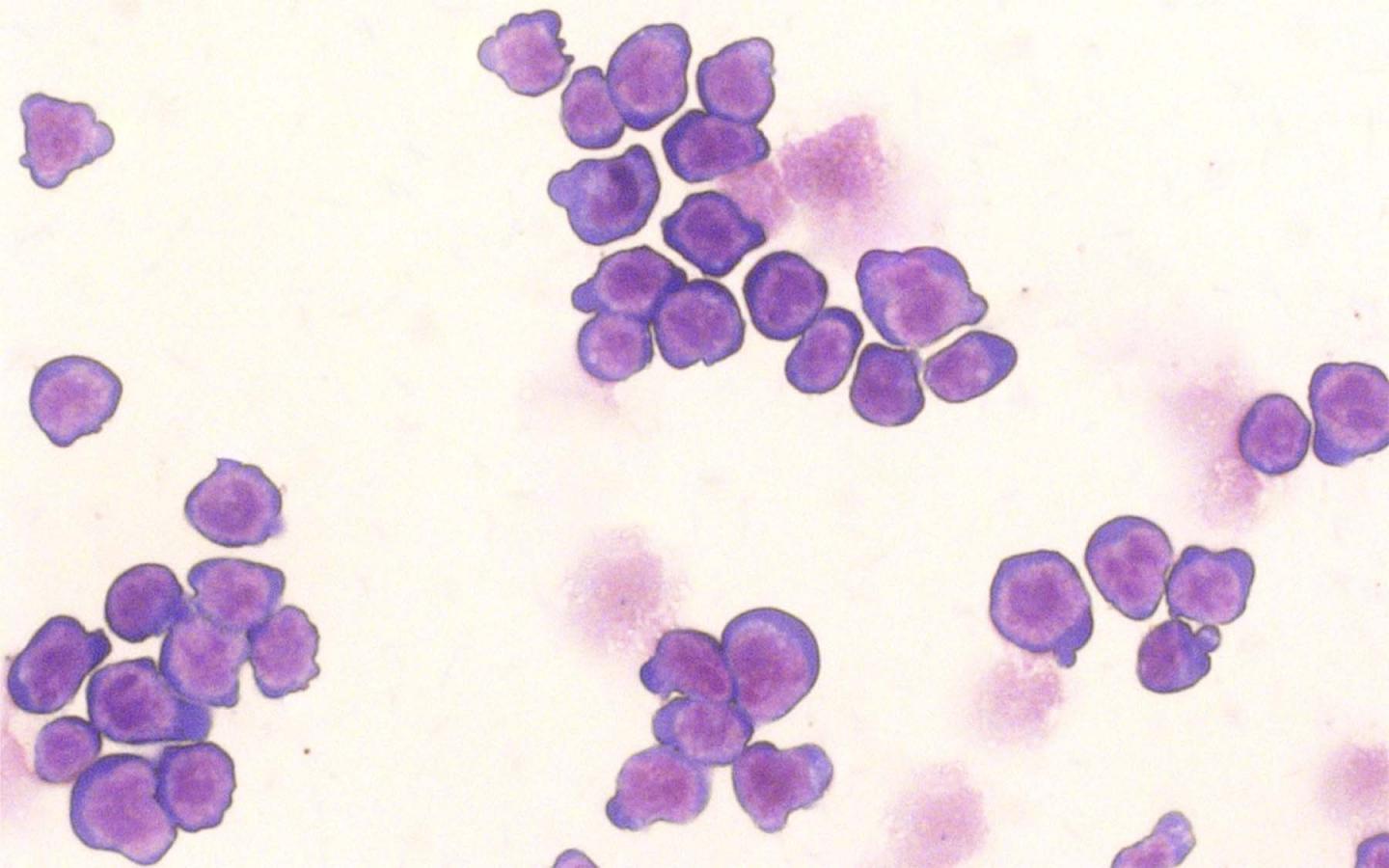 Immature Blood Cells