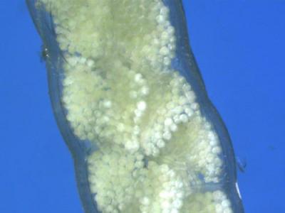 <i>Aplysia californica</i> (Sea Hare) Eggs
