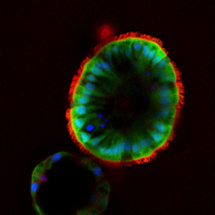 Gentzsch Nasospheroids