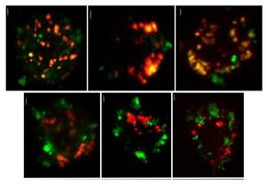 Elevated CXCL4 levels inhibit the TLR9 signaling pathway