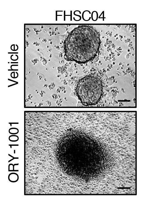 Notching A Win Against Treatment-Resistant Lung Cancer (1 of 1)