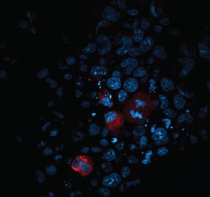Transposon Activity in Stem Cells