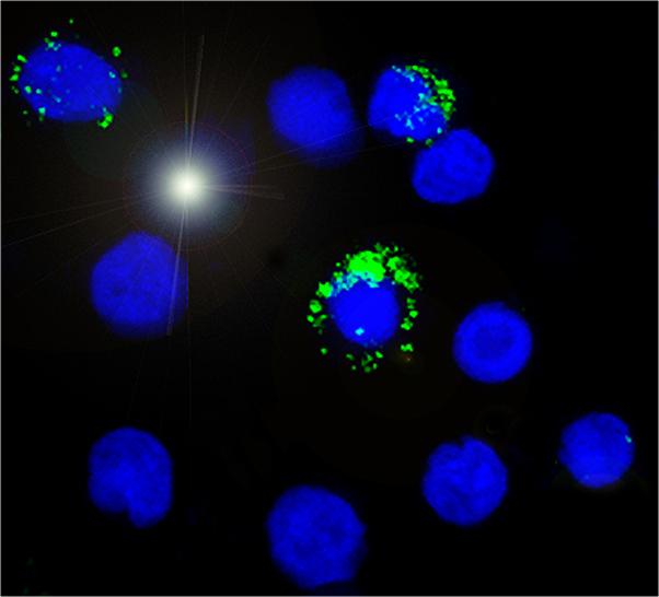Hepatitis B Virus Surface Antigen