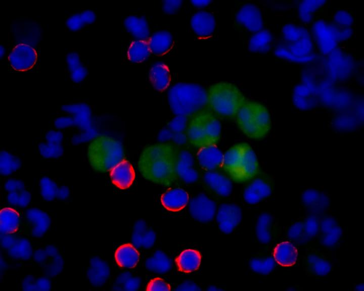 Single Circulating Tumor Cells