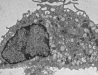 Un-infected macrophage