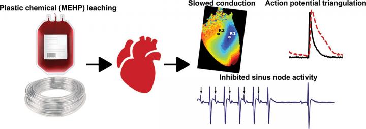 Phthalates and Cardiac Electrophysiology