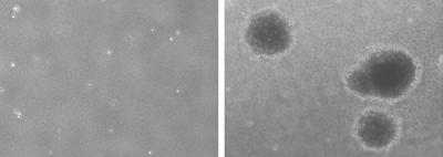 Mdm2 Suppresses Cell Transformation