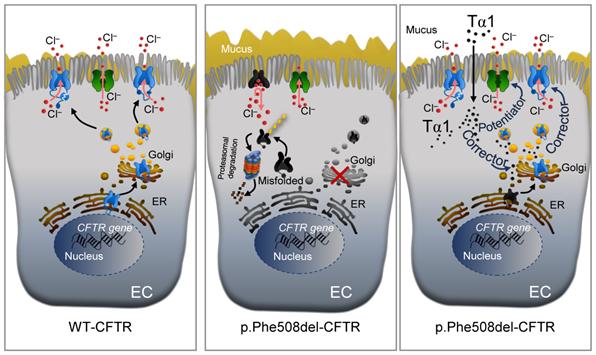 Effect of Thymosin α1 in Cystic Fibrosis