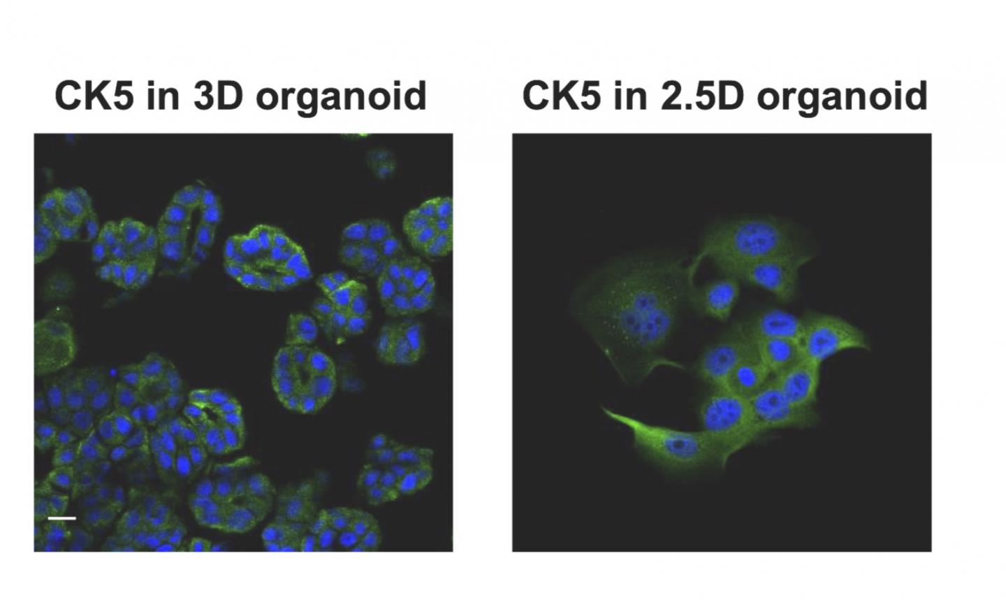 CK5 Expression