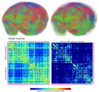 Differences between whole-brain connectomes when using a fiber-tracking algorithm with optimized versus default parameters