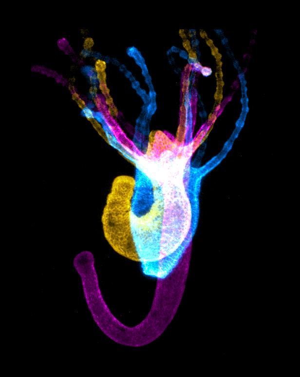 Three Muscular Positions of Hydra -- Calcium Imaging