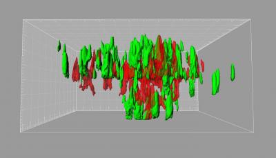 3-D Representation from TB Tubercle