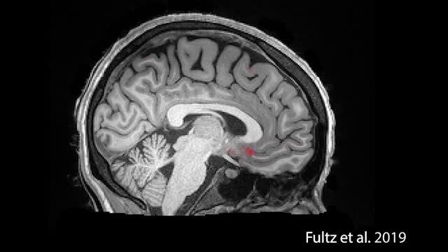 During Sleep, the Brain Exhibits Large-Scale Waves
