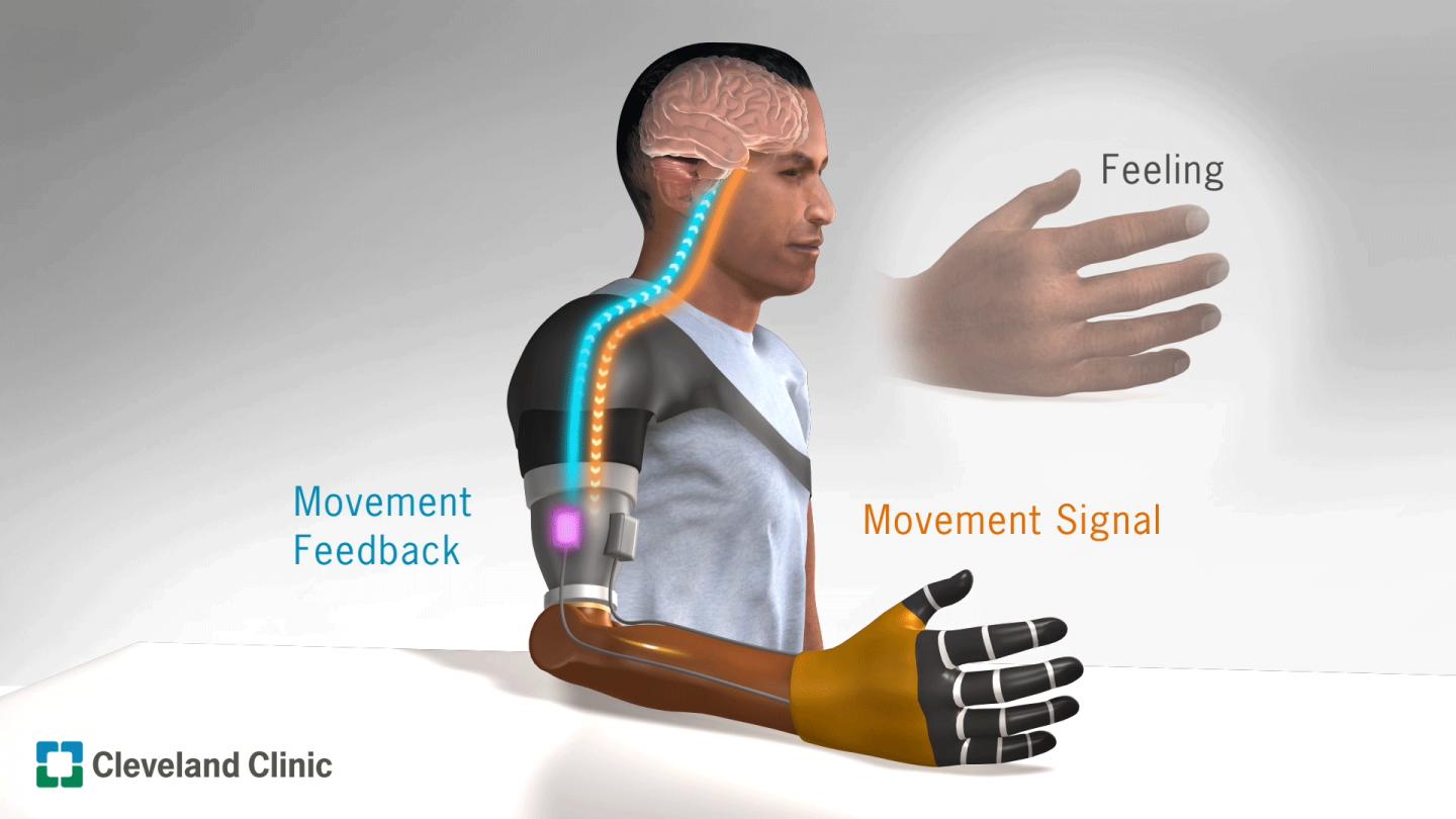 Cleveland Clinic Research Finds Illusory Movement Perception Improves Motor Control for Prosthetics 