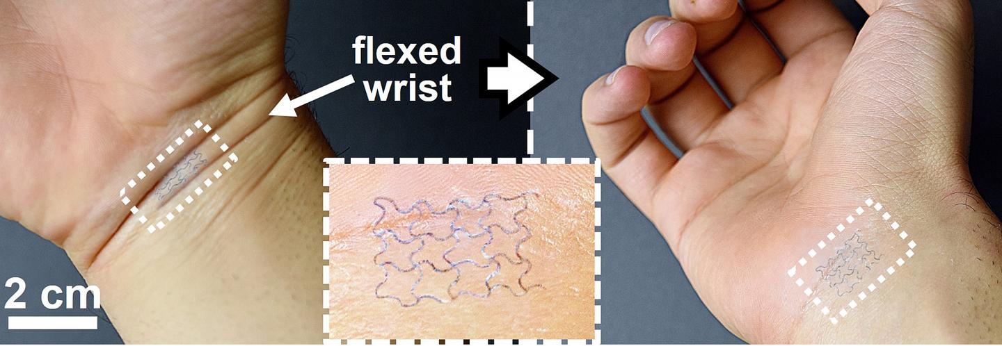 Wearable Medical Electronic Device
