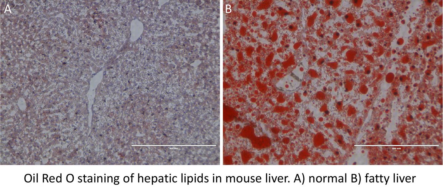 Lipids in Mouse Liver, Normal vs. Fatty