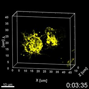 Action of Antibodies on a B Cell