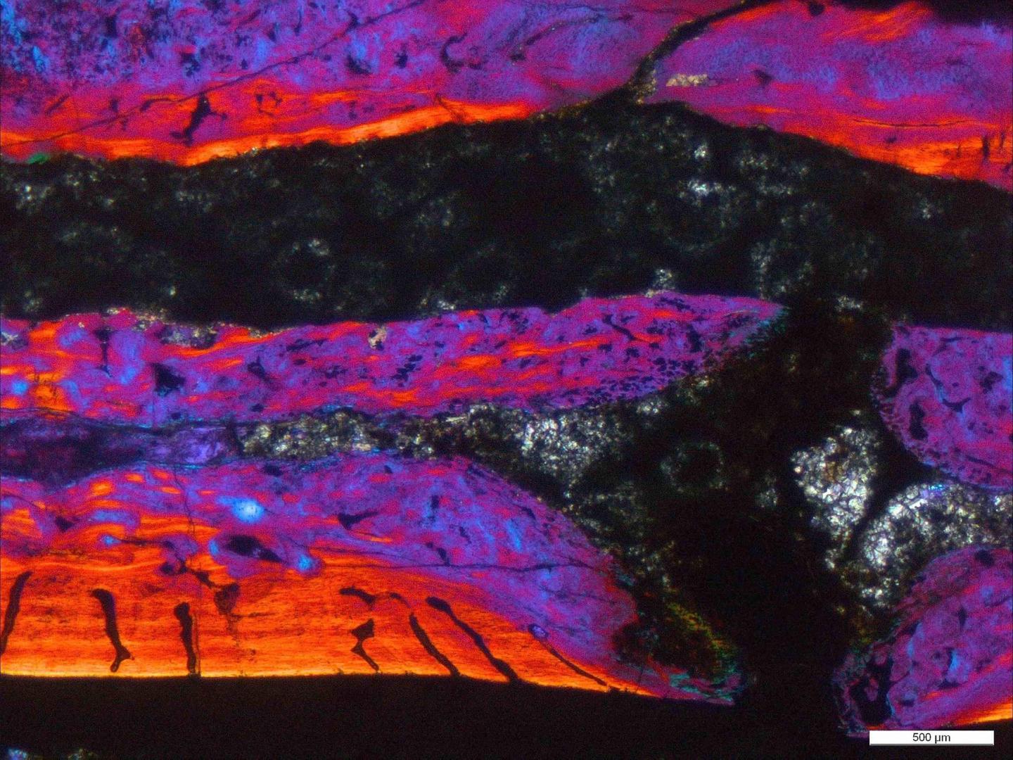 Thin section of the spine in the light microscope