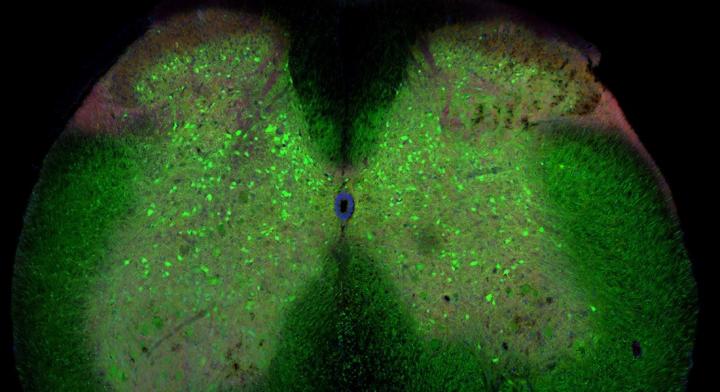 ALS development in mouse