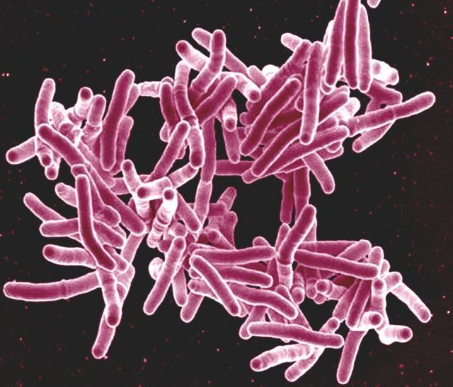Mouse model of contained tuberculosis infection could lead to a more effective vaccine