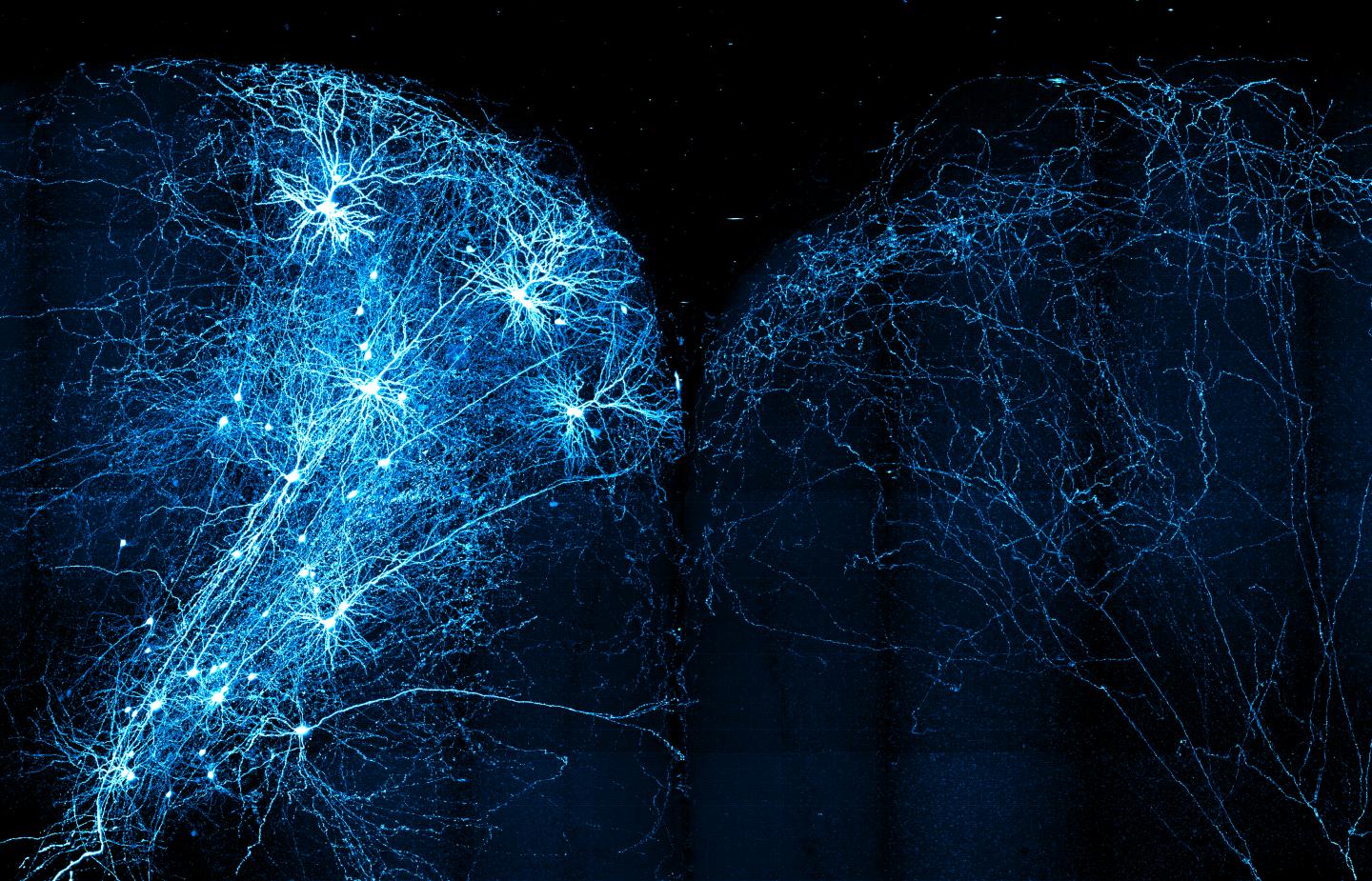 Traced Mouse Neurons