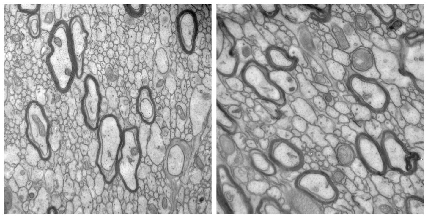 Neuronal CTGF Controls Myelination