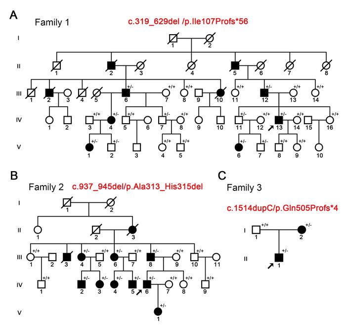 Figure 1: Identification of mutations in the NPRL3 gene in three pedigrees with focal epilepsy