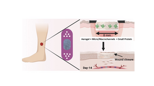 Microchannel-Containing Nanofiber Aerogels with Small Protein Molecule Enable Accelerated Diabetic Wound Healing