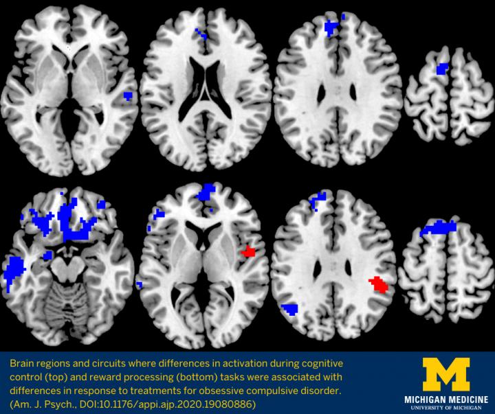 OCD Brain Activation