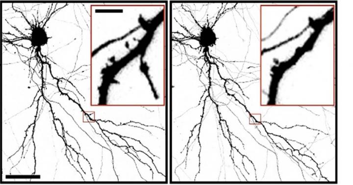 Neuron Spines