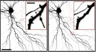 Neuron Spines