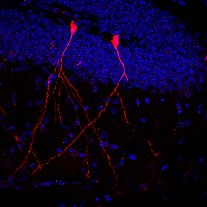 Bacterial Vesicles in the Brain