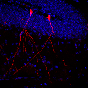 Bacterial Vesicles in the Brain