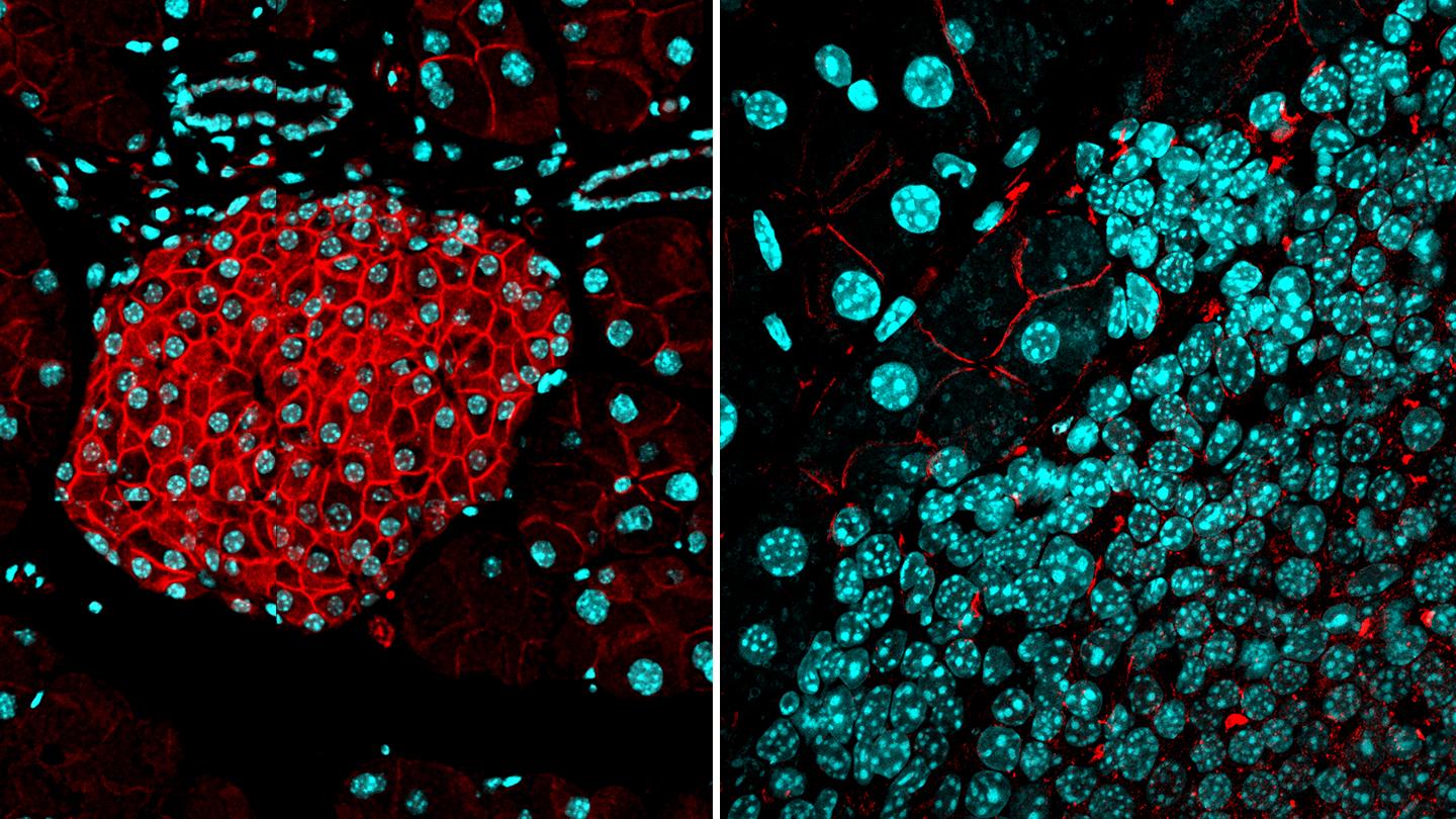 Loss of a Barrier to Tumor Formation