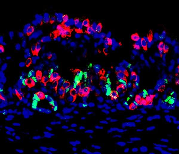 Mini-Stomach Engineered to Produce Insulin-Secreting Cells