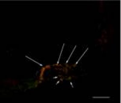 Cochlear Microinjection