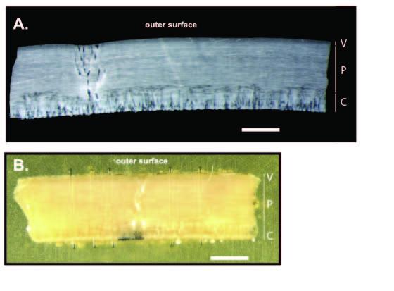 Thin section photomicrograph of a modern ostrich eggshell