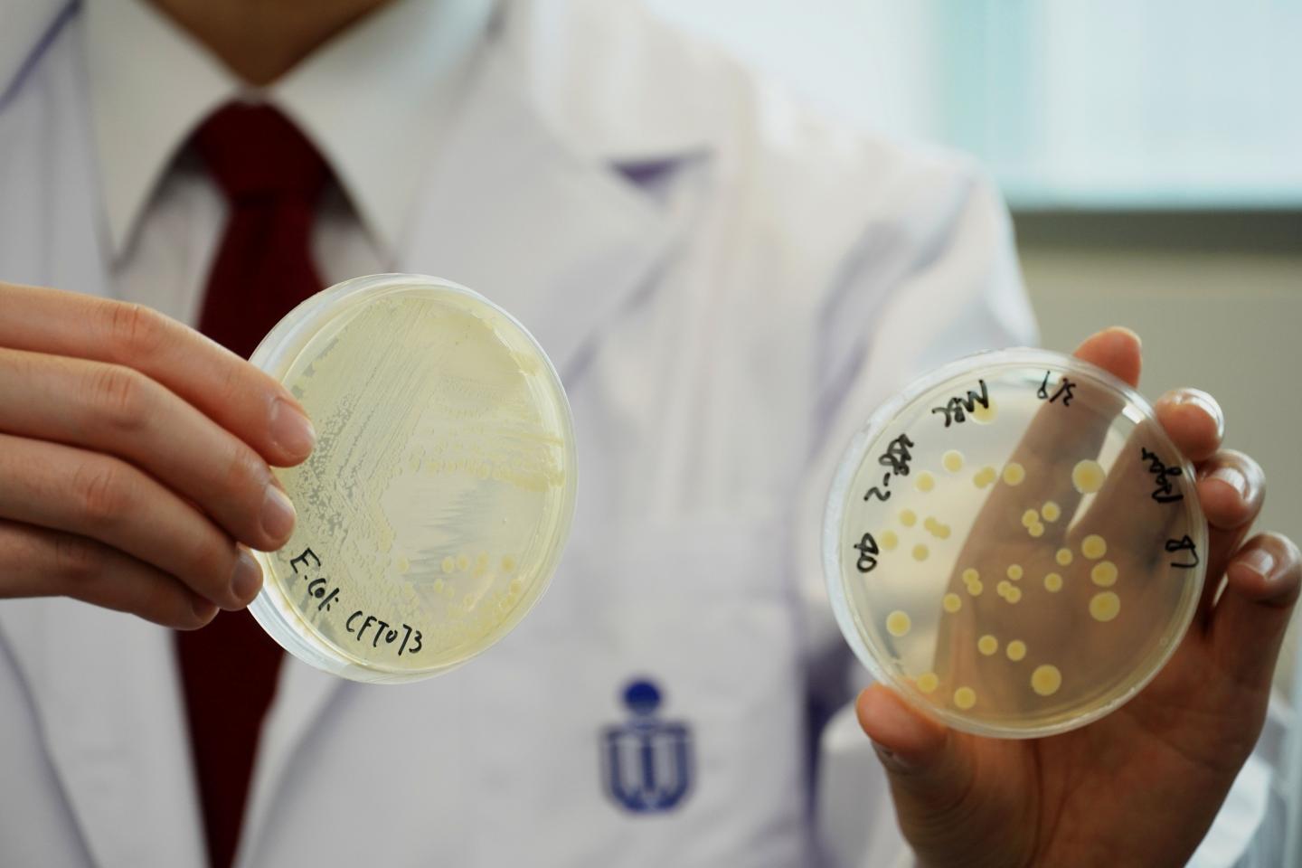 The Dish on the Left Is the <i>E. coli</i> Cloned by the Research Team
