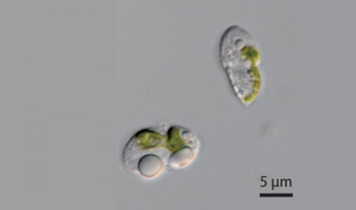 Organellogenesis Still a Work in Progress in Novel Dinoflagellates