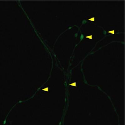 Local Translation at Synapses