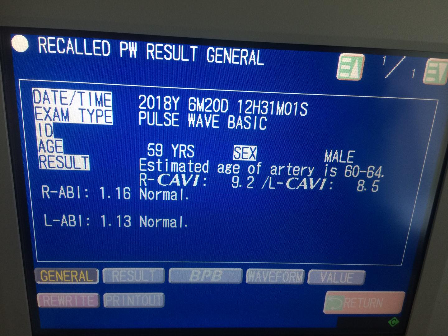 Screenshot of CAVI Measurement