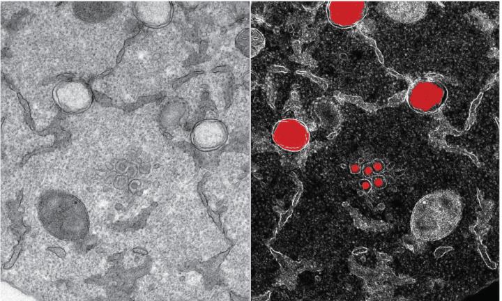 SARS-CoV-2 Hijacking Its Host Cell's Compartments