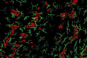 Macrophages