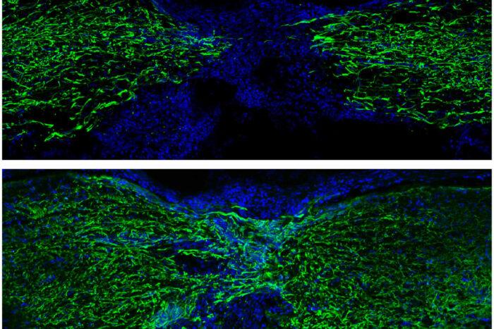 Zebrafish use surprising strategy to regrow spinal cord