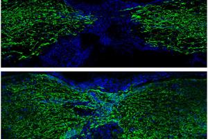 Zebrafish use surprising strategy to regrow spinal cord