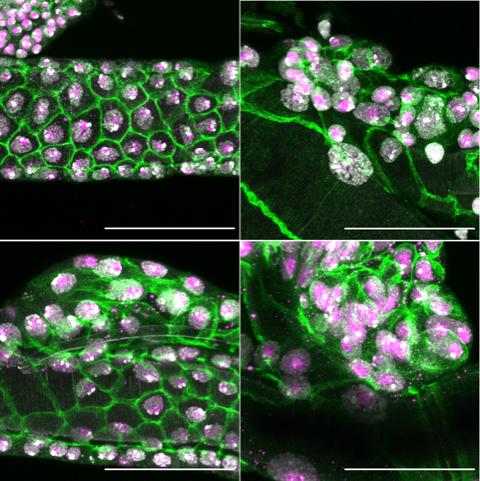 Tracheal cells of Drosophila larvae, destined to form the adult tissue structures.