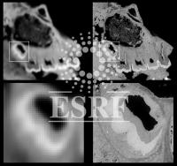 Teeth in CT and Synchrotron Microtomography